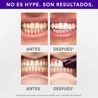 PURPLE STRIPS V34 - Tiras blanqueadoras
